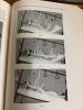 The Treatment of Fractures by Lorenz B&ouml;hler - 11
